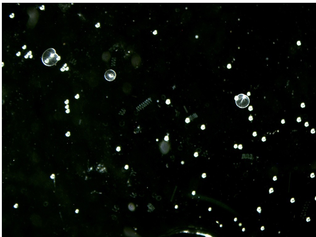 Noctiluca are seen under a microscope in white on a black background.
