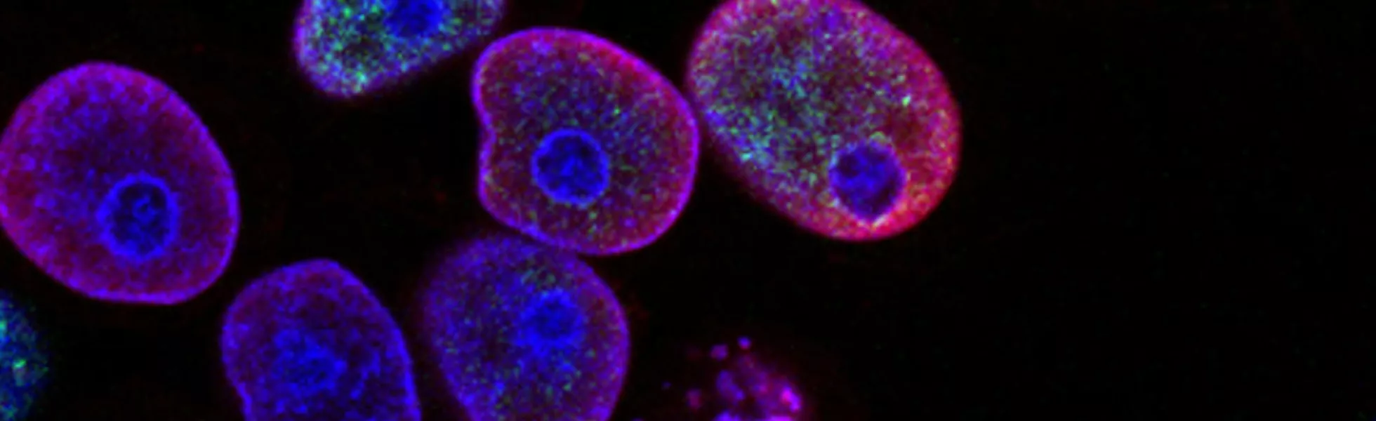 Human colorectal cancer cells stained with multiple colors of dye in order to study a cancer therapy.